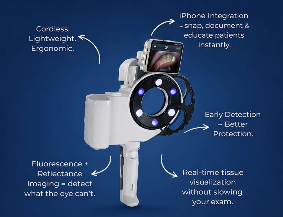 Velscope