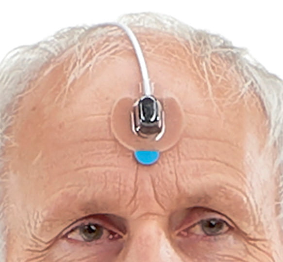 Forehead Sensor