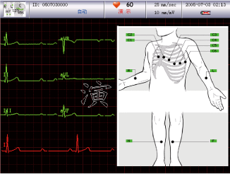 Lead connection diagram